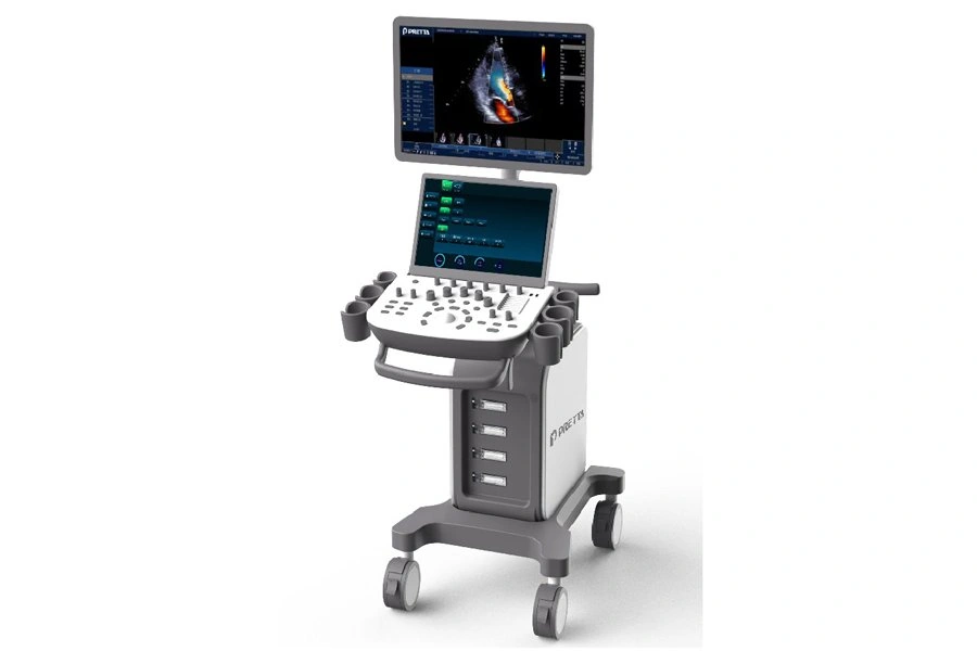 DOPPLER ULTRASOUND